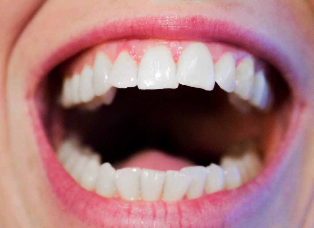 teeth pixabay